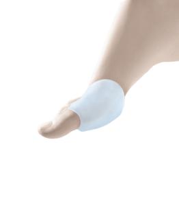 bunion splints